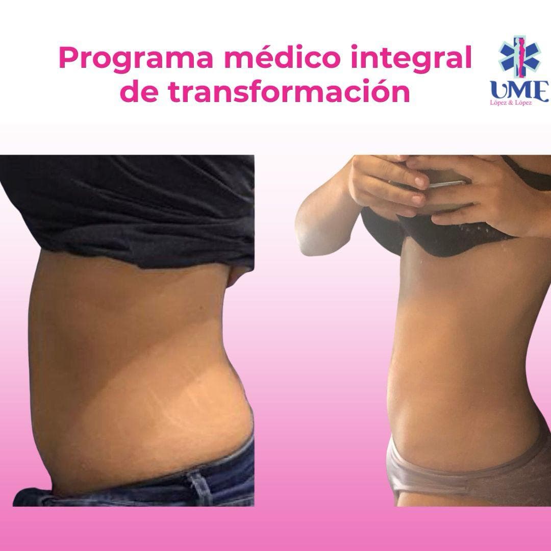 Resultado visual de transformación corporal